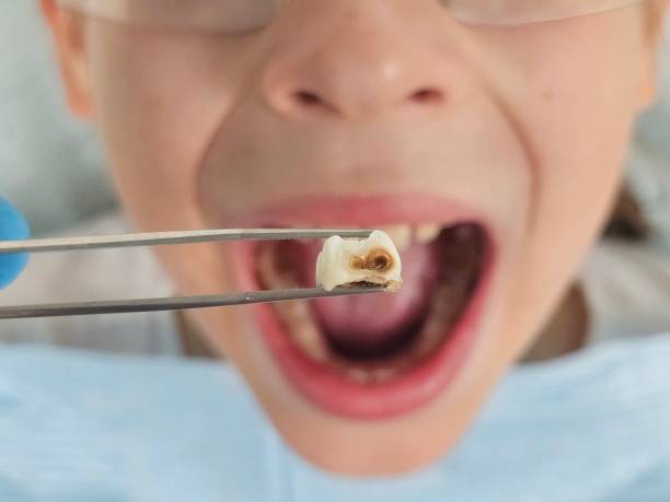 Best Pediatric Emergency Dentist in Sunnyside, GA